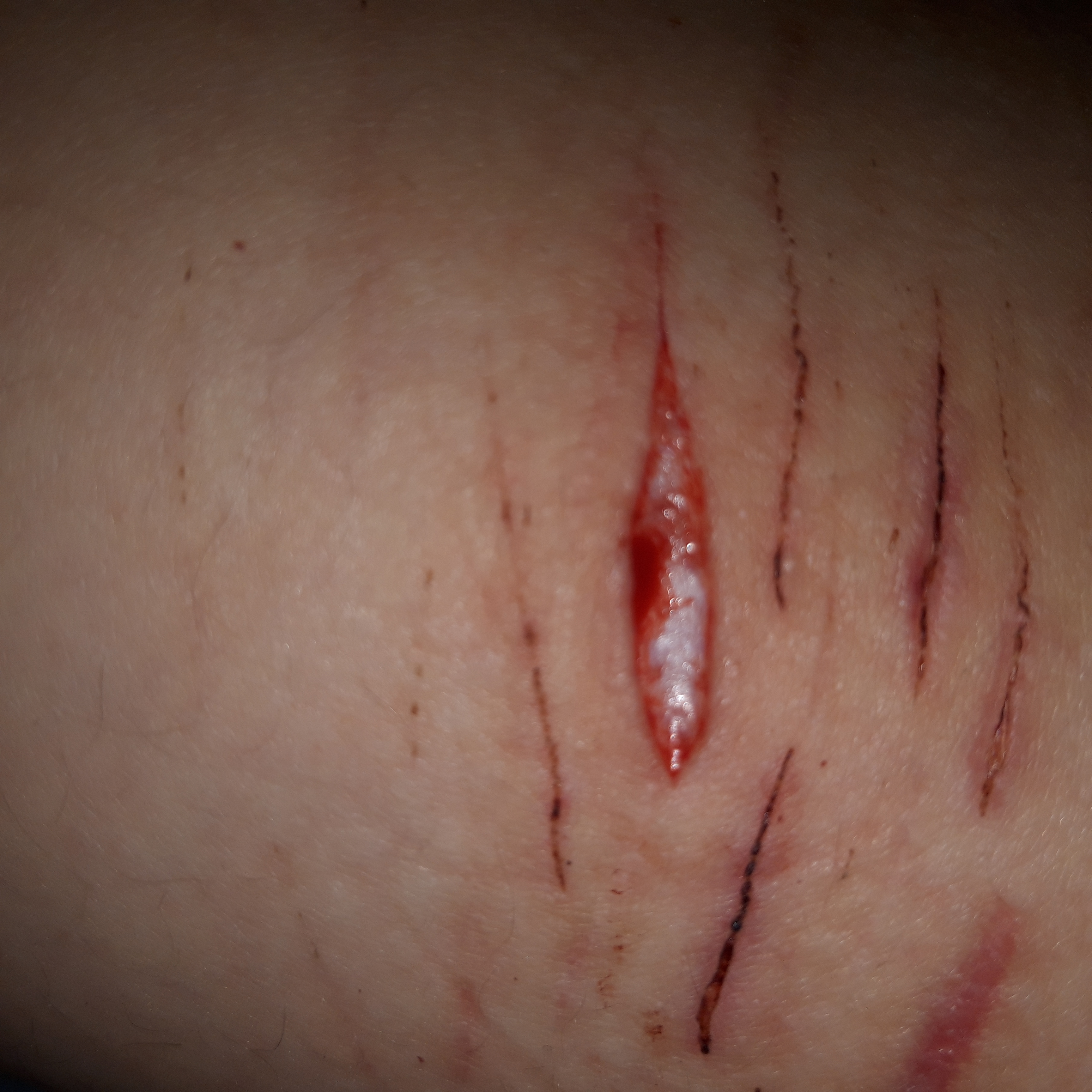 The pills they gotta go